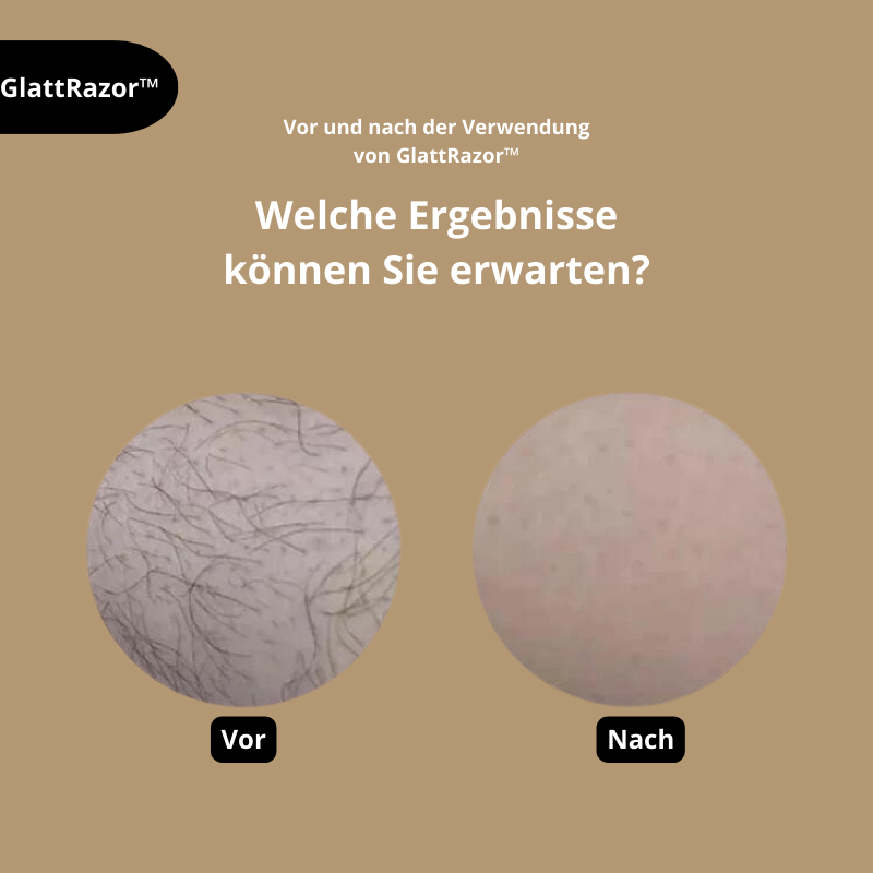 GlattRazor | Unverzichtbar